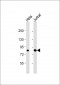 CHUK Antibody(C-term)
